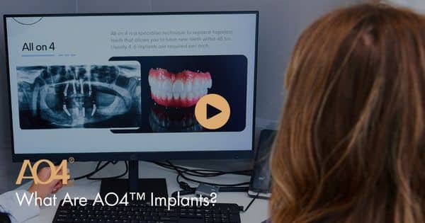 Ao4 Overview What Are All-On-4® Implants? - AO4™