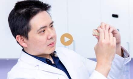 What Is the Recovery Time After Getting All-On-4 Plus® Implants?