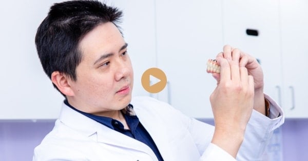 What Is the Recovery Time After Getting All-On-4 Plus® Implants?