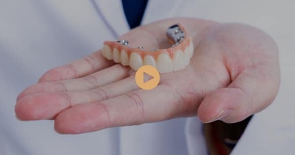 What Is the Success Rate of All-On-4 Plus® Implants?