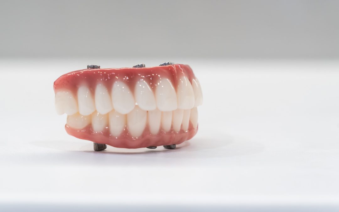 Getting Dental Implants at Couture Implant Centre in Sunbury