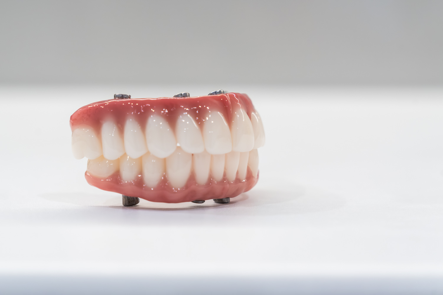 Getting Dental Implants at Couture Implant Centre™™ in Sunbury