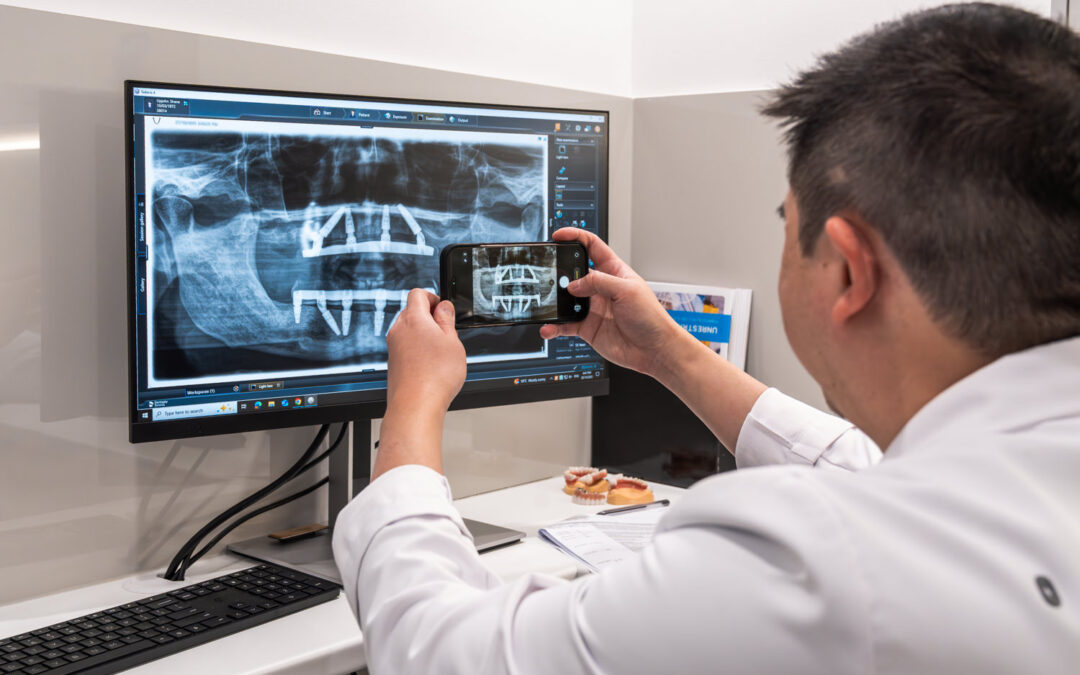 Teeth Replacement Cost in Sunbury: A Long-Term View