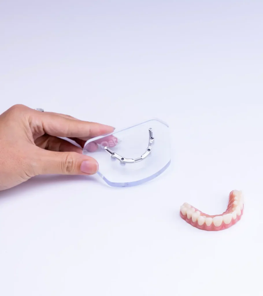 Are You Suited for an Implant Bridge at Couture Implant Centre