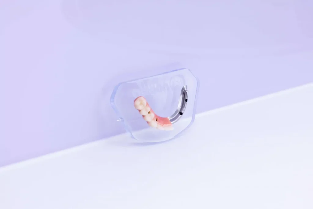 Implant Bridge in Couture Implant Centre Melbourne