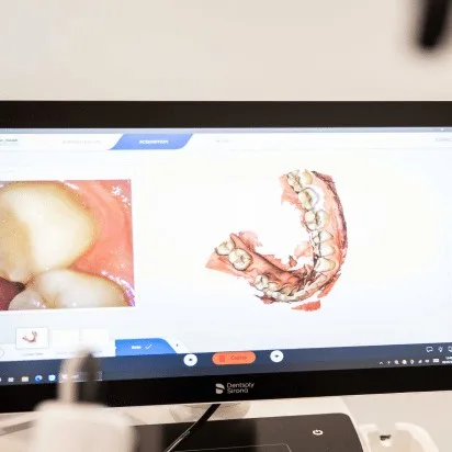 Intraoral camera imaging at Couture Implant Centre