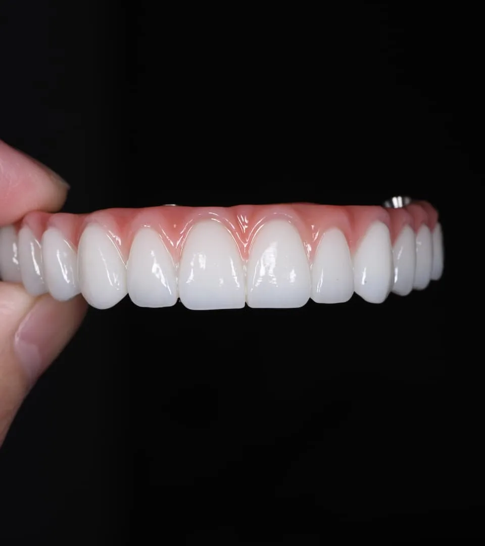 Tailored All-On-4 Plus Treatment Plan at Couture Implant Centre