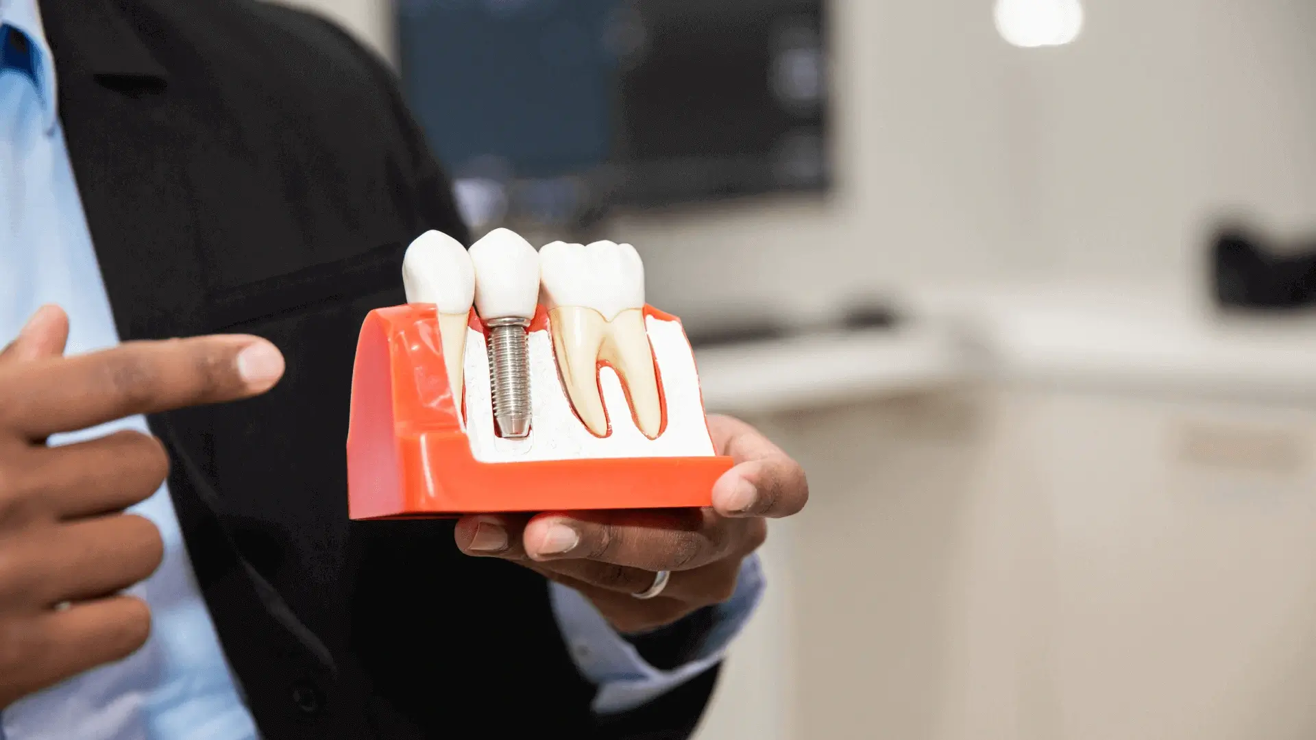 Dental implant treatment: bone assessment