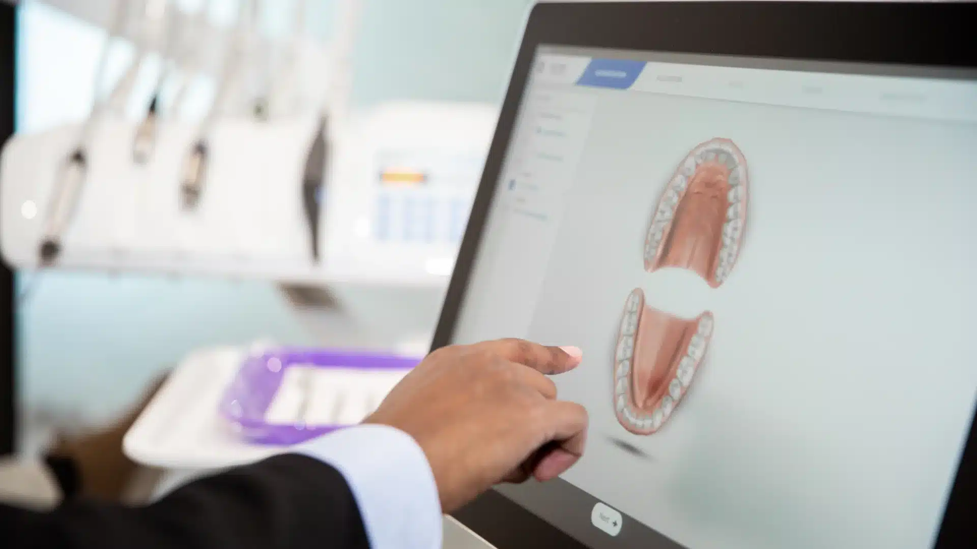 Designing and placing your new teeth — step 2