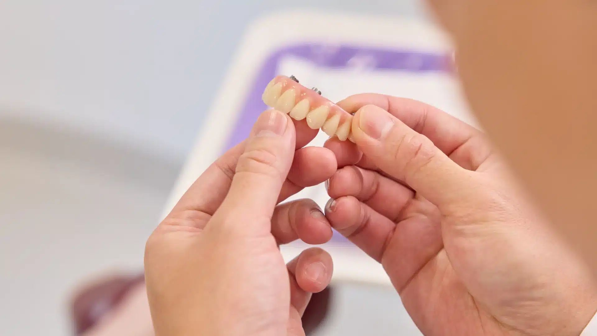 Designing and placing your new teeth — step 3