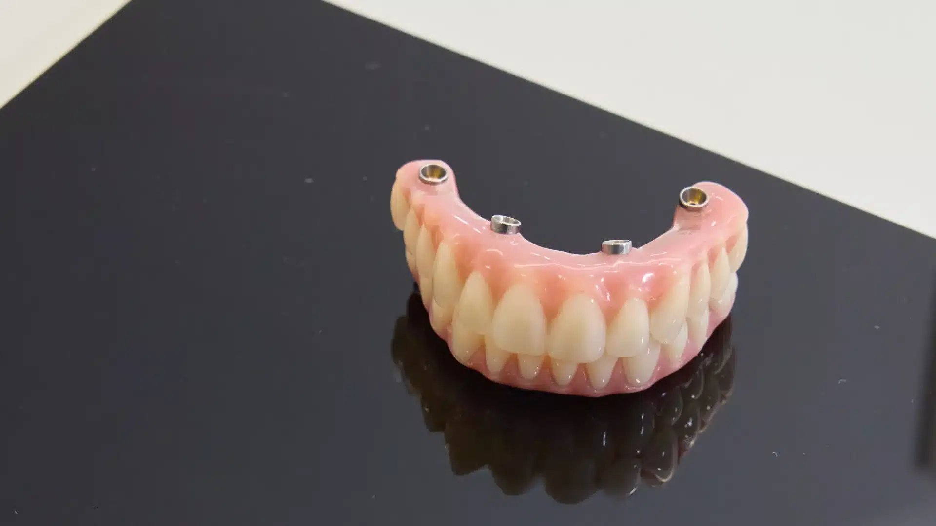 Designing and placing your new teeth — step 4